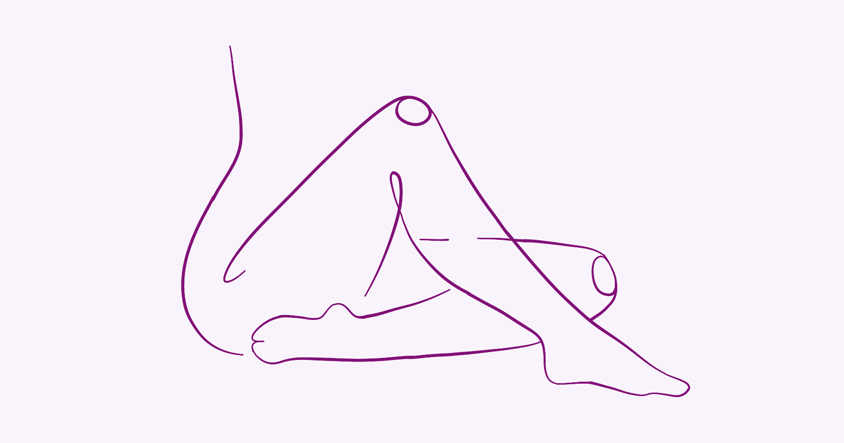 Пролапс тазовых органов у женщин