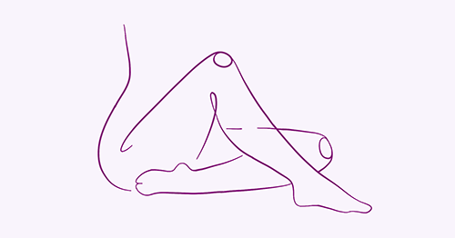 Пролапс тазовых органов у женщин