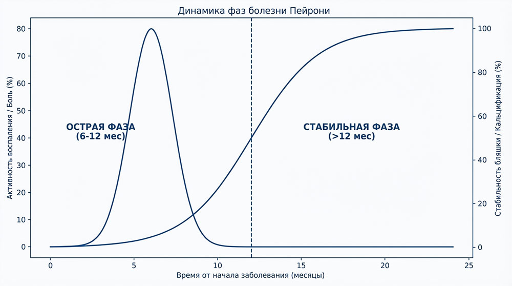 Болезнь Пейрони