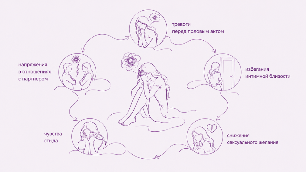 Пролапс тазовых органов и интимная жизнь3.png